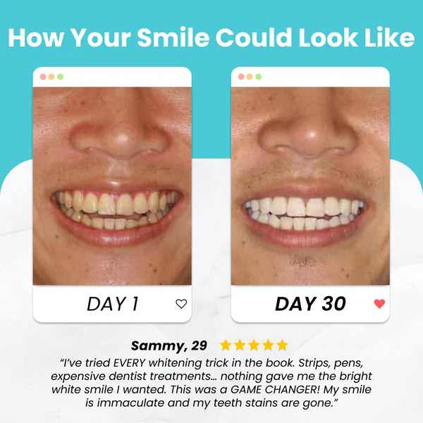 Missing Gem™ UltraBite