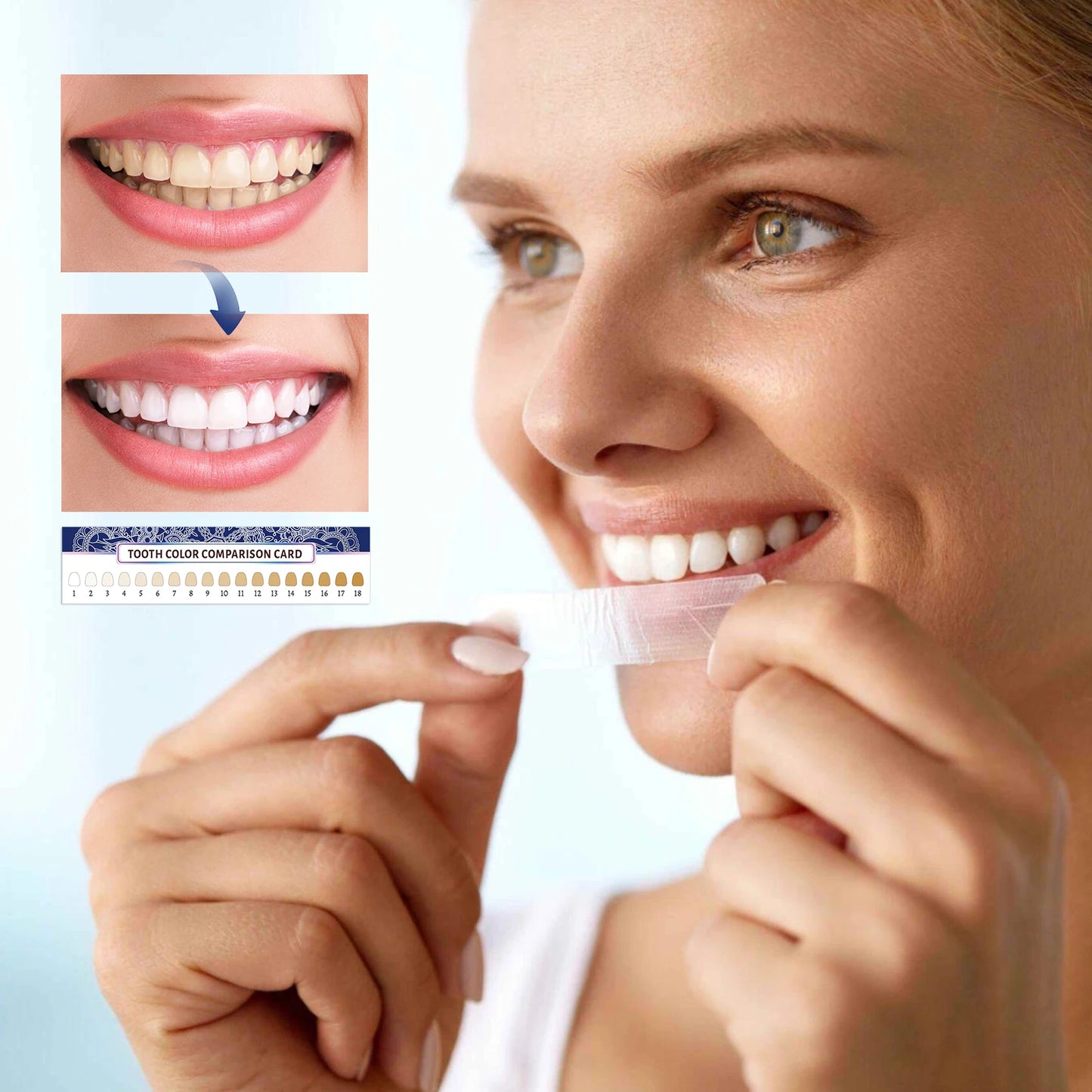 SmileLift