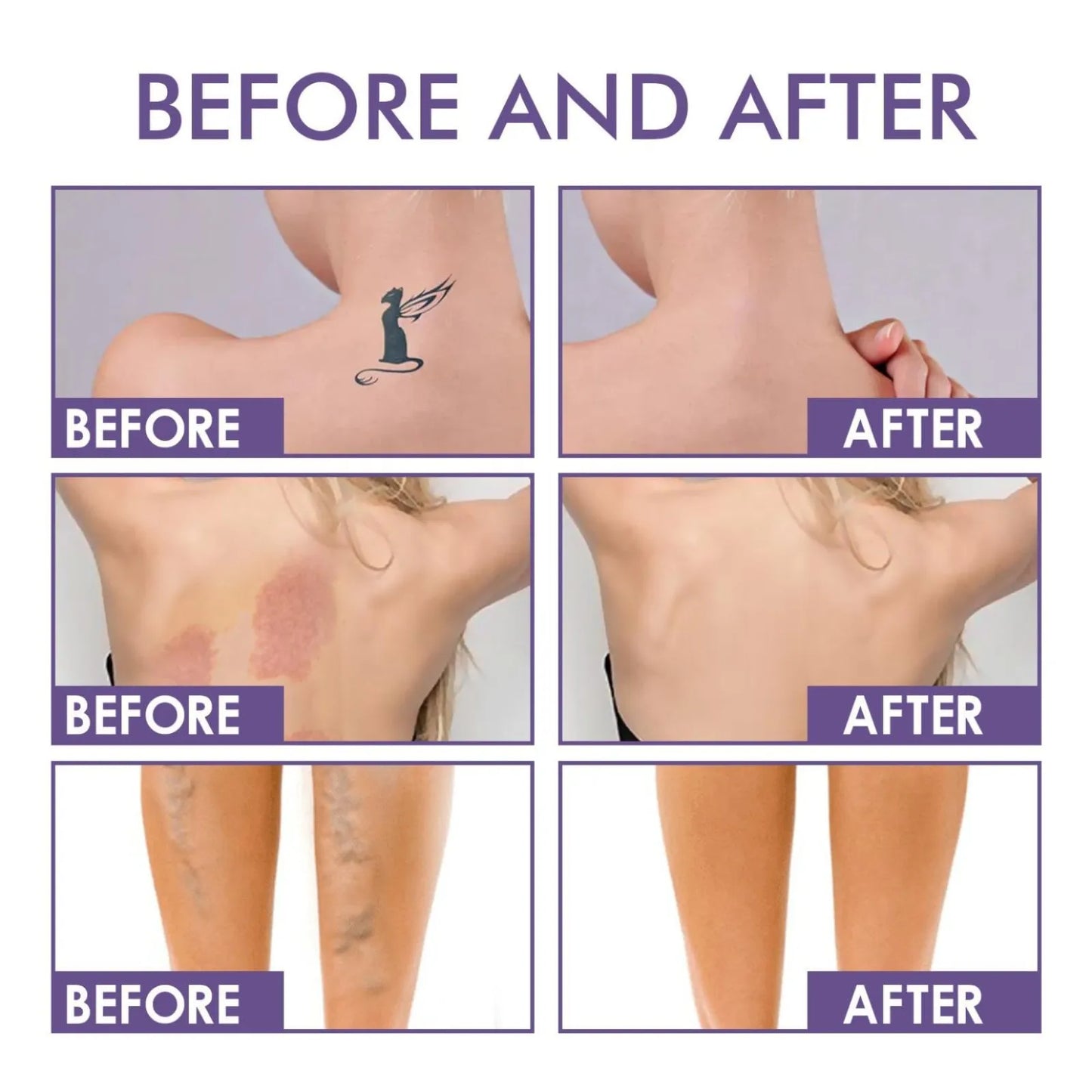 DermaVeil™ Body Coverage Perfector