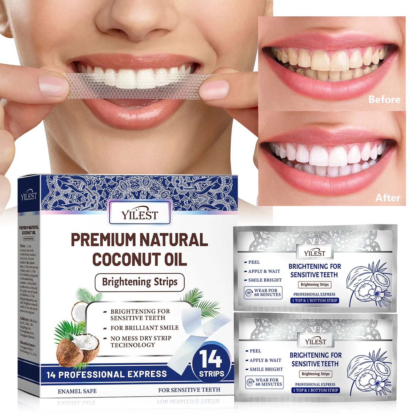 SmileLift