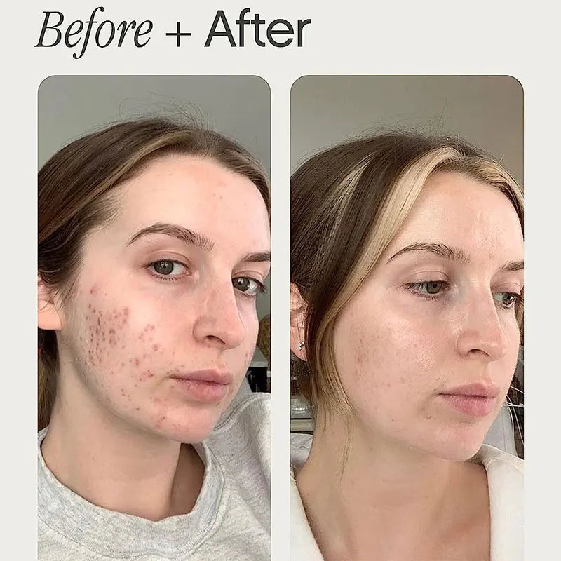 Clearé Glow