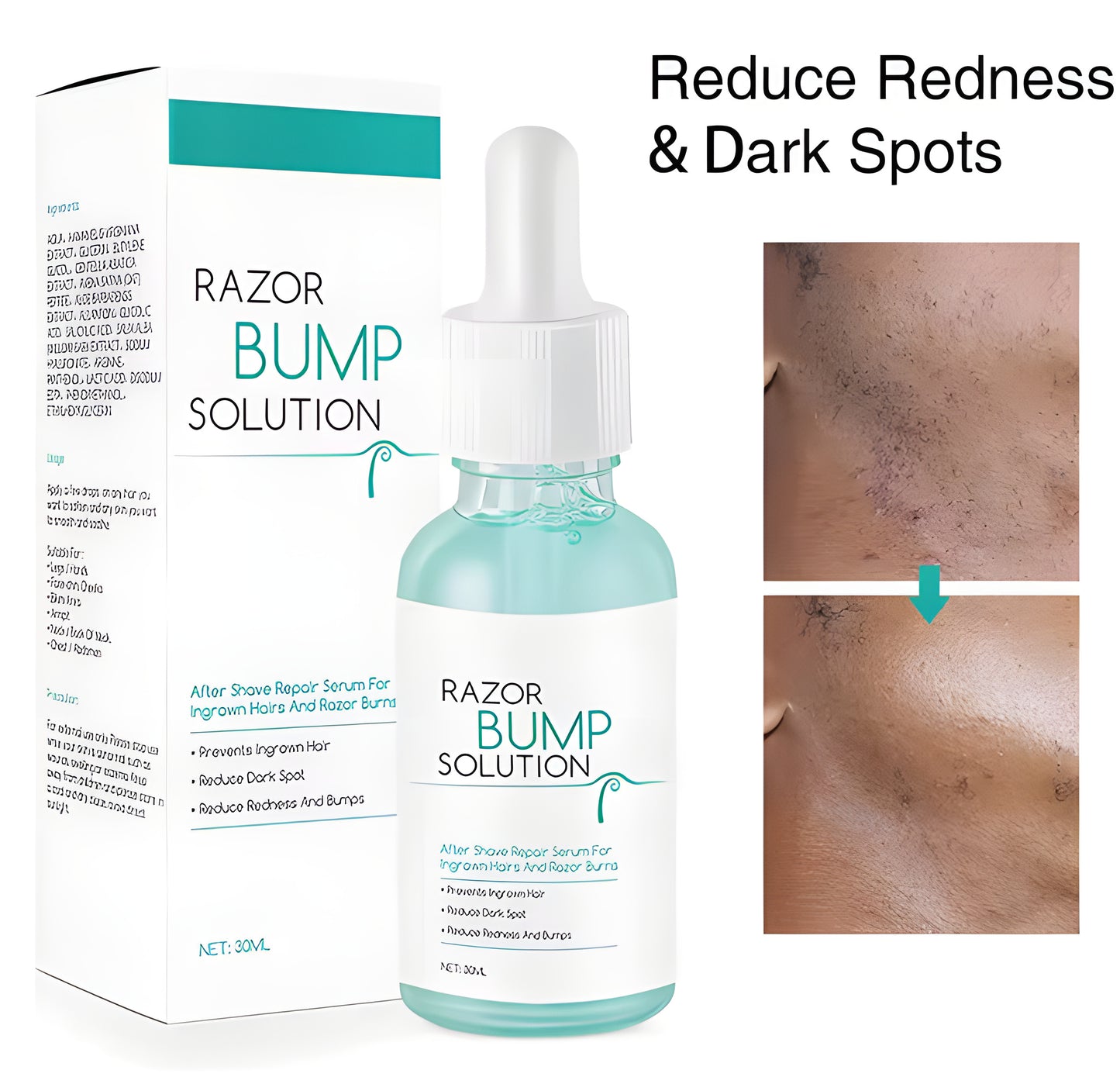 Razor Bump Serum