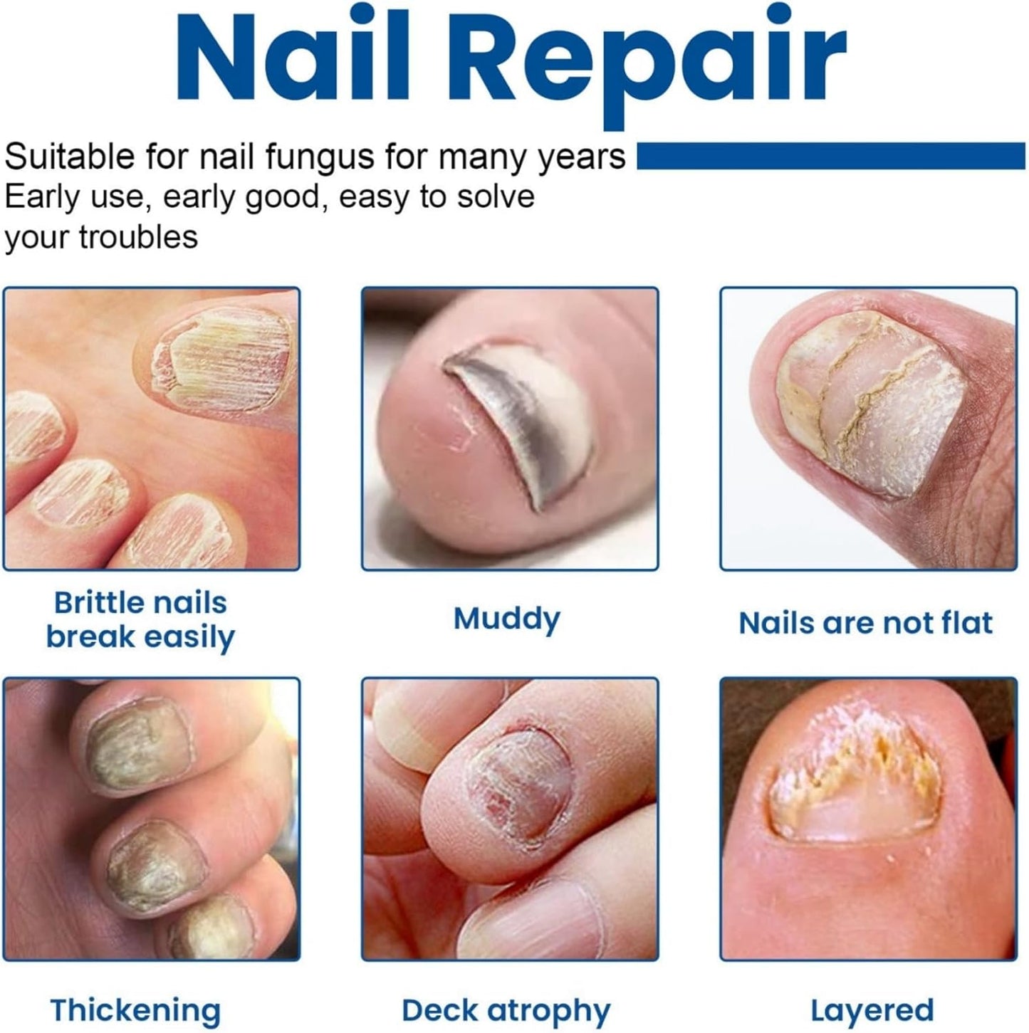 Missing Gem™ ToeGuard