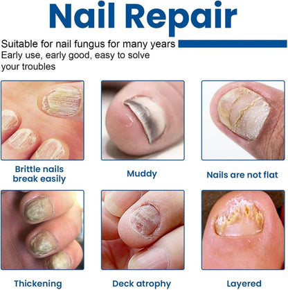 Missing Gem™ ToeGuard