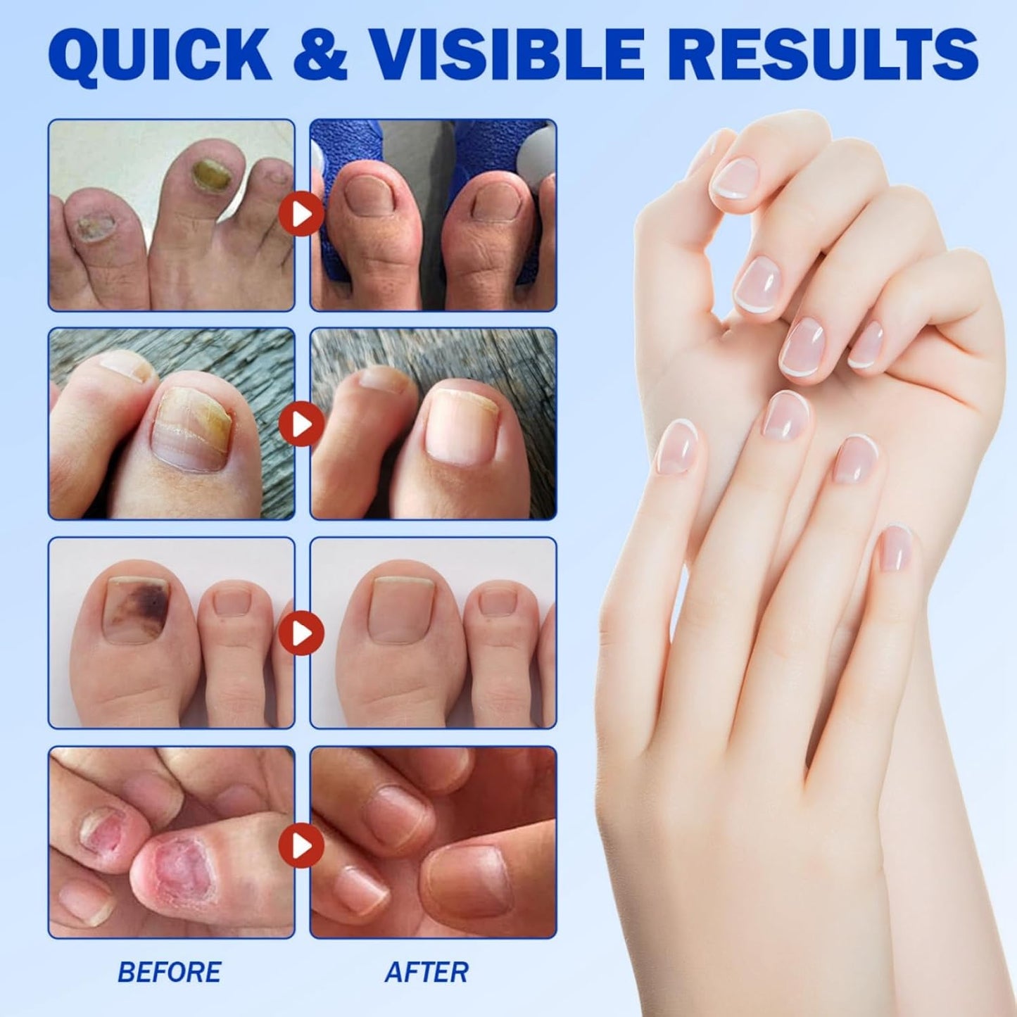 Missing Gem™ ToeGuard