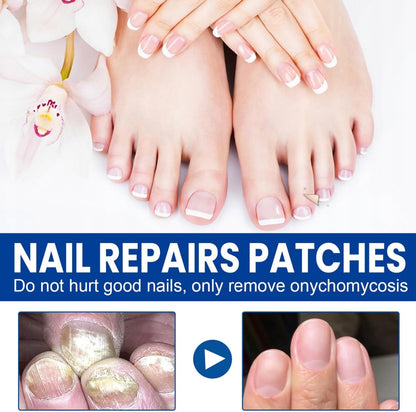 Missing Gem™ ToeGuard