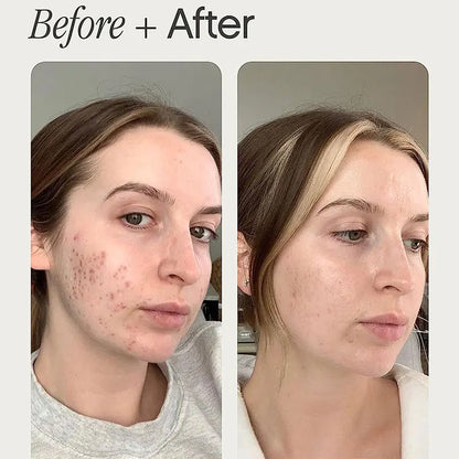 Clearé Glow