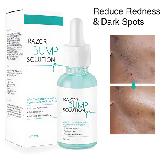 Razor Bump Serum
